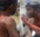  Video, Acid attack on Boy in Agra,  Agra Nurse throws acid on Lab Assistant, Lab assistant dead #agranews