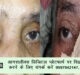  Black Fungus Patient dramatically improved after orbital decompression in SN Medical College, Agra #agranews