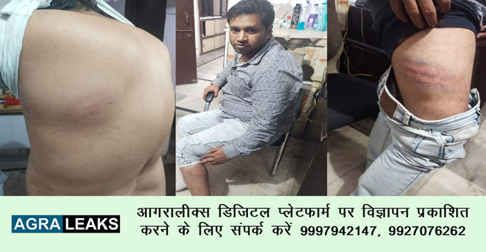 Rooftop restaurant operator in Agra accuses police of torture…#agranews