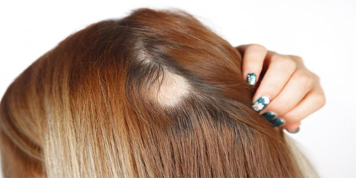  Officers wife lodge FIR against Saloon owner & two others after hair damage during treatment