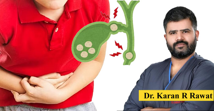  Health Update: Gallstones are a common problem but timely treatment is necessary: ​​Dr. Karan R. Rawat
