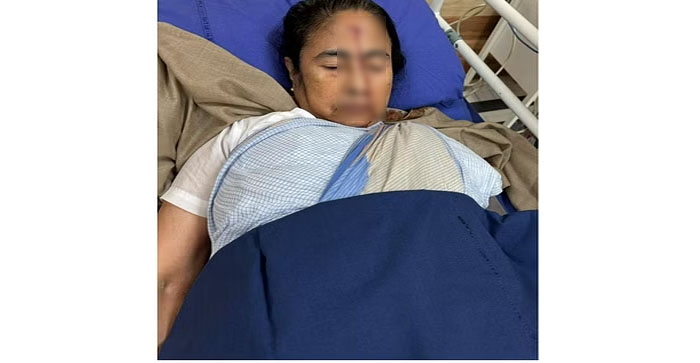  West Bengal Chief Minister Mamata Banerjee suffered an injury on her forehead…admitted to hospital