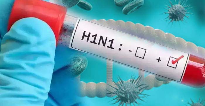  Agra News: First case of swine flu found in Agra. Admitted to SN’s isolation ward…#agranews