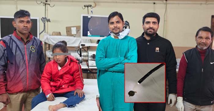  Agra News: 2 cm battery cell was removed through endoscopy of a 10 year old girl in SNMC, Agra…#agranews